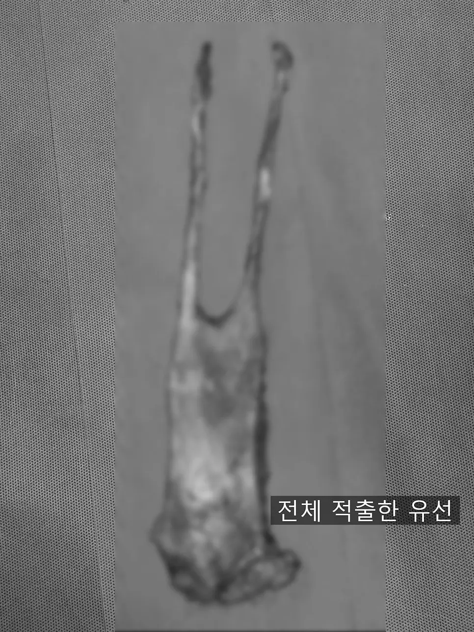 14살 고양이 유선종양 전적출 수술했어요