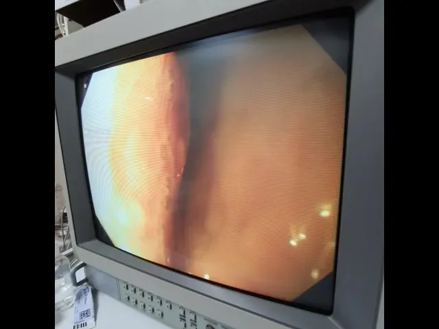 6살 강아지 식도이물 내시경처치