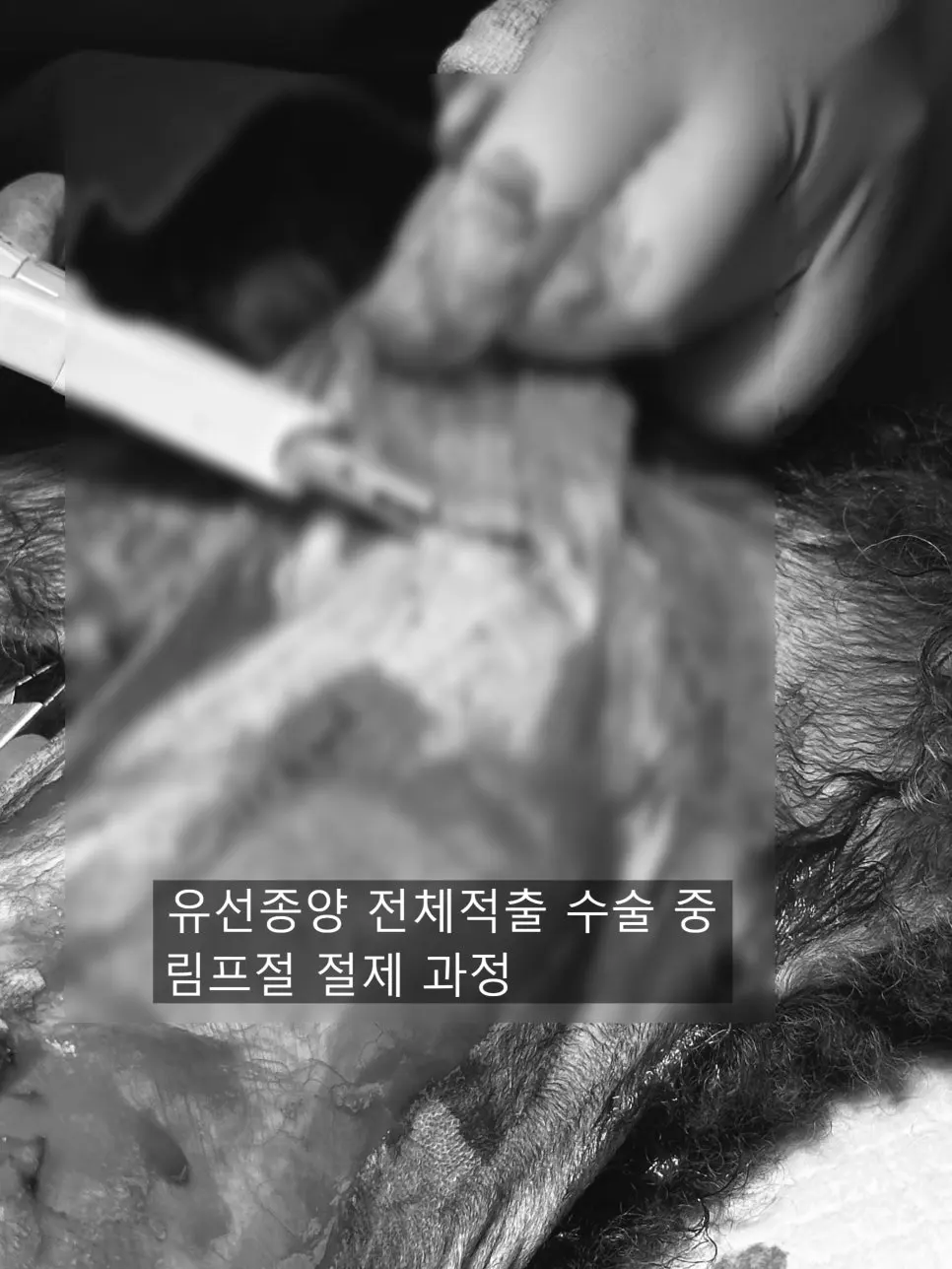 12살 강아지 유선종양 전적출, 중성화 수술했어요