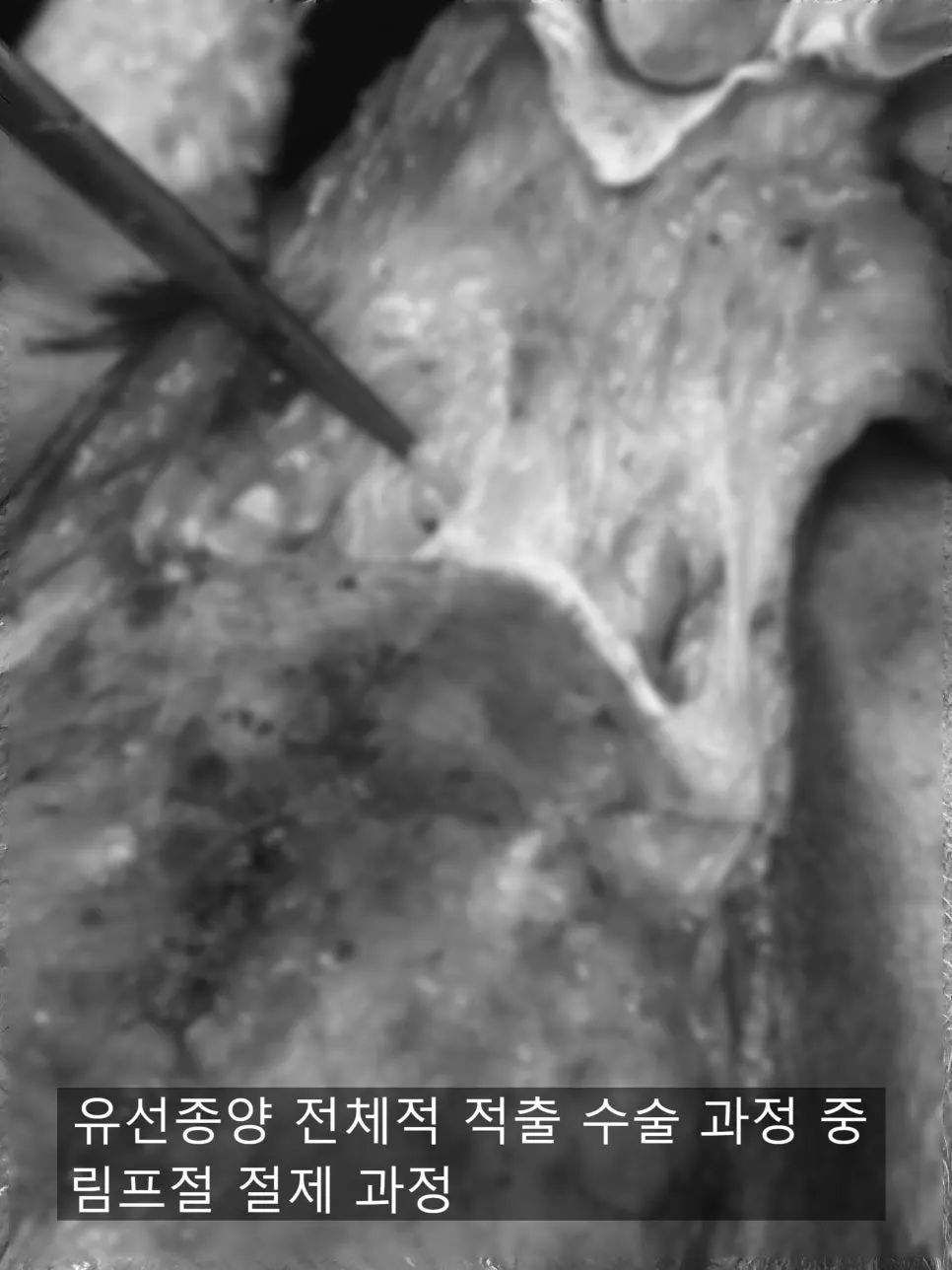 6살 강아지 유선종양 전체적 적출 수술, 중성화 수술했어요