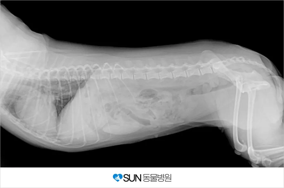 다섯 살 난이의 유선종괴수술 이야기