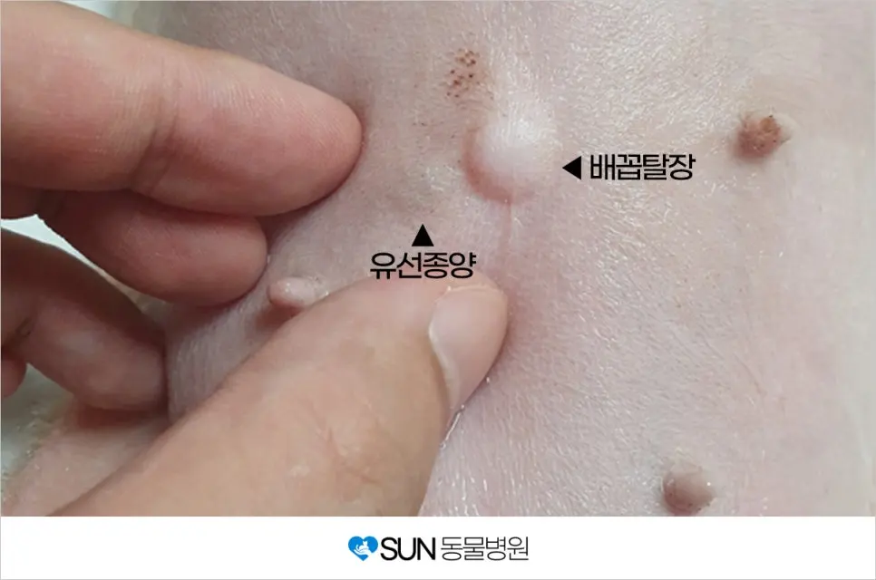 다섯 살 난이의 유선종괴수술 이야기