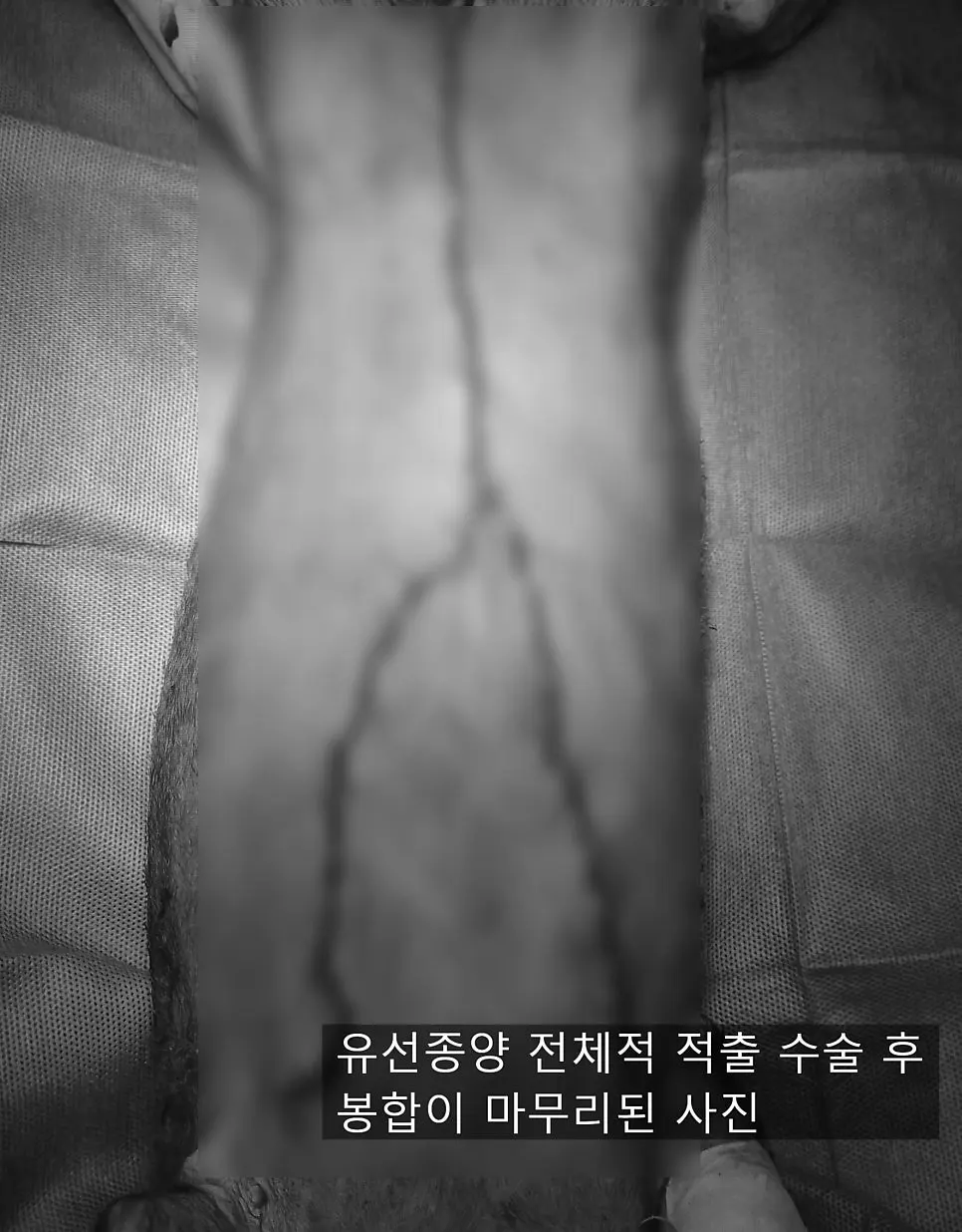8살 강아지 유선 전체 적출 수술, 중성화 수술, 목뒤 종괴 제거 수술했어요