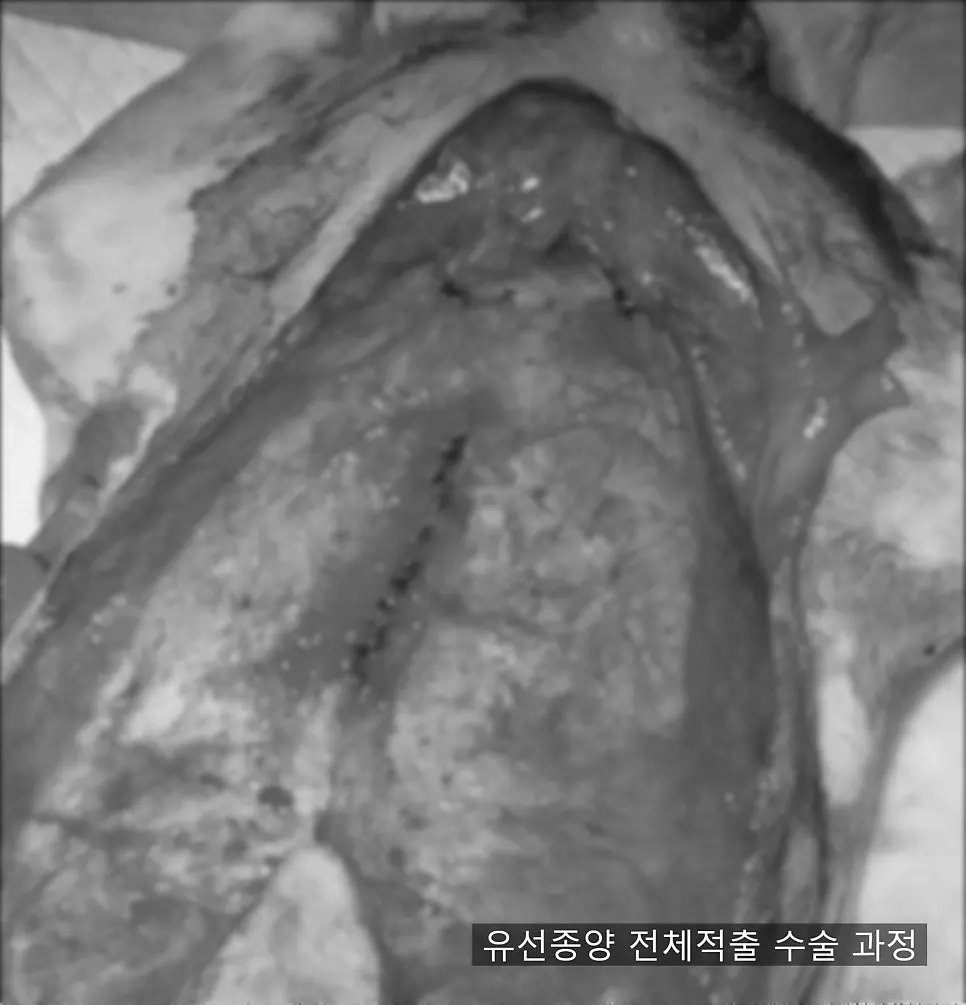 12살 강아지 유선종양 전체 적출 수술, 중성화 수술, 스케일링했어요