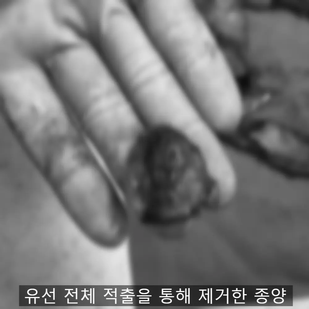 12살 강아지 유선 종양 전체 적출,중성화 수술,스케일링 했어요