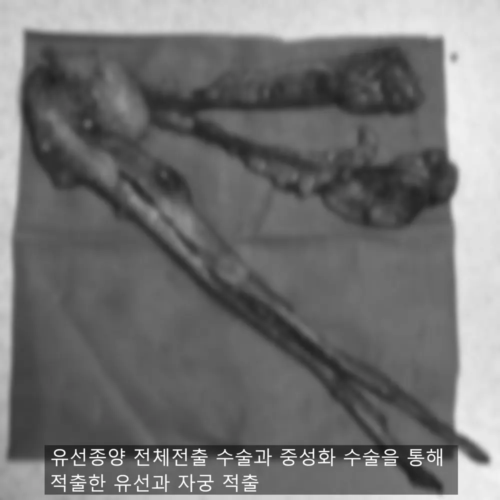 12살 강아지 유선 종양 전체 적출,중성화 수술,스케일링 했어요