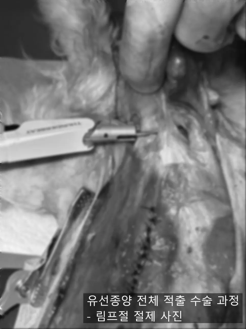 13살 강아지 유선종양 전체 적출 수술, 피부 종괴 제거 수술, 외음부 종괴 제거 수술했어요