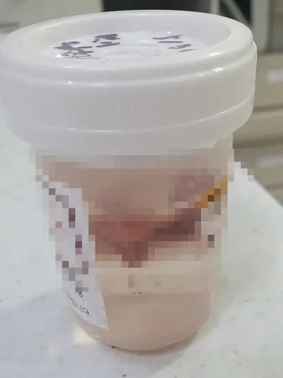 6살 강아지 유선종양