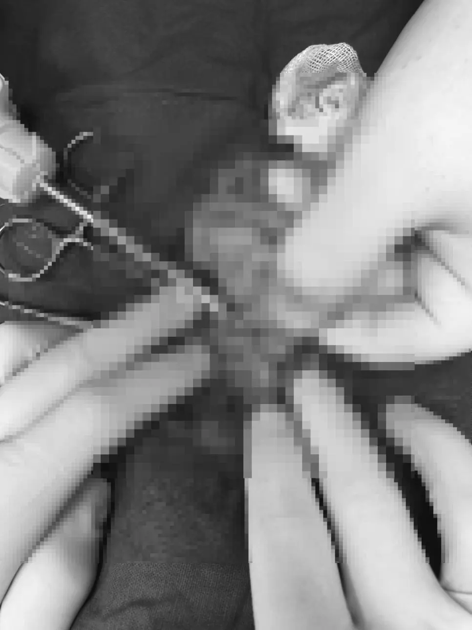강아지 유선종양 수술 병원선택전 참고할 3가지 케이스