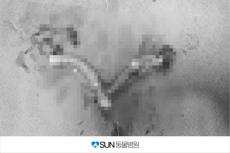 제거된 자궁난소
