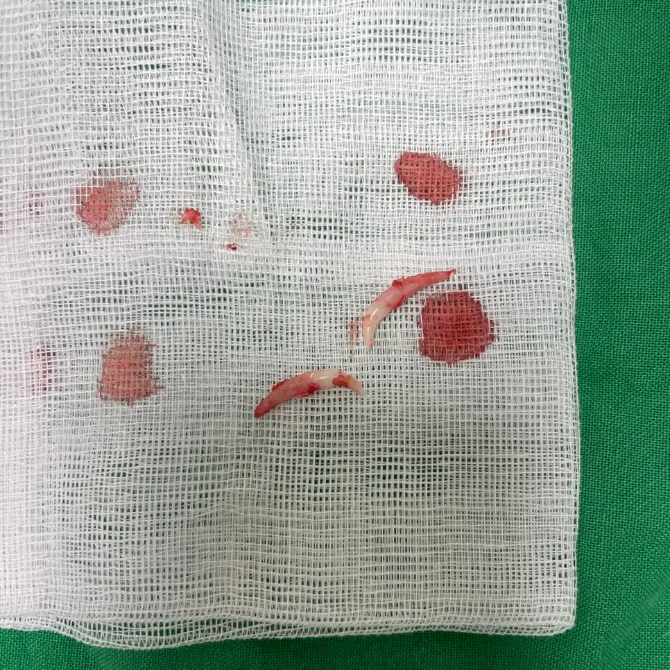 권선구동물병원 강아지 치과 유치발치