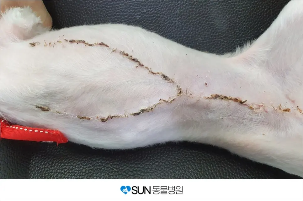 수술 후 1주일 뒤 봉합사 제거 후