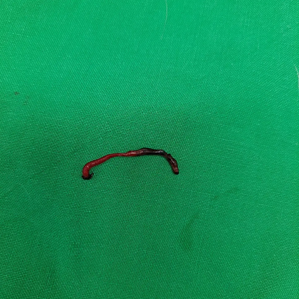 수원 고양이동물병원 고양이 장폐색 수술