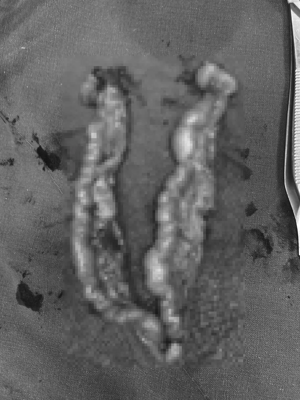 영통 동물병원 강아지 유선종양 수술