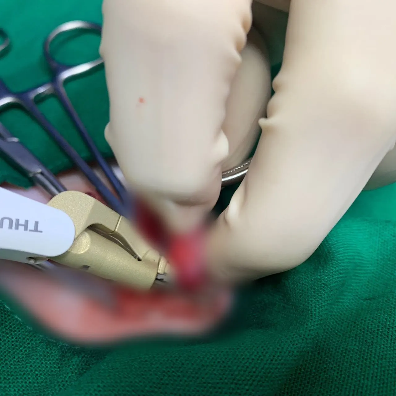 오늘 썬 동물 병원에 방문한 찌미입니다. 우리 찌미는 암컷 고양이로 중성화… 사진 4