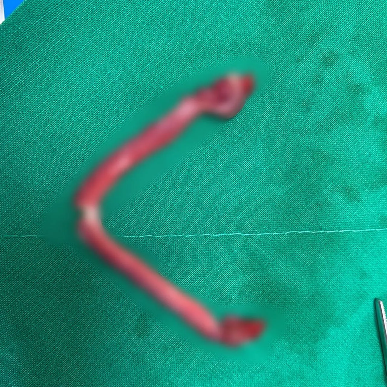 오늘 썬 동물 병원에 방문한 찌미입니다. 우리 찌미는 암컷 고양이로 중성화… 사진 5